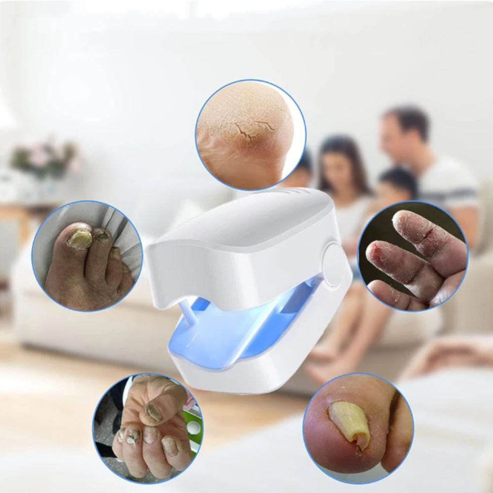 Novanail™ | Aantrekkelijke nagels in 14 dagen