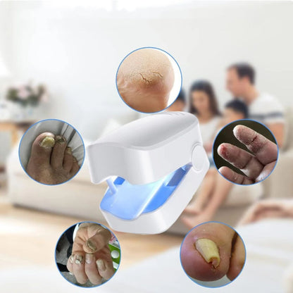 Novanail™ | Aantrekkelijke nagels in 14 dagen