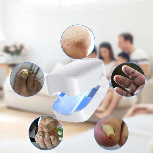 Novanail™ | Aantrekkelijke nagels in 14 dagen