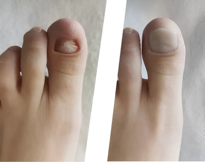 Novanail™ | Aantrekkelijke nagels in 14 dagen