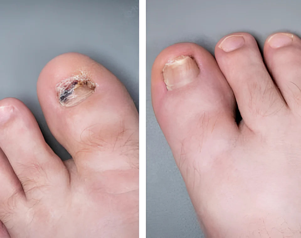 Novanail™ | Aantrekkelijke nagels in 14 dagen